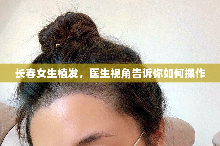 长春女生植发，医生视角告诉你如何操作