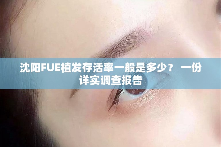 沈阳FUE植发存活率一般是多少？ 一份详实调查报告