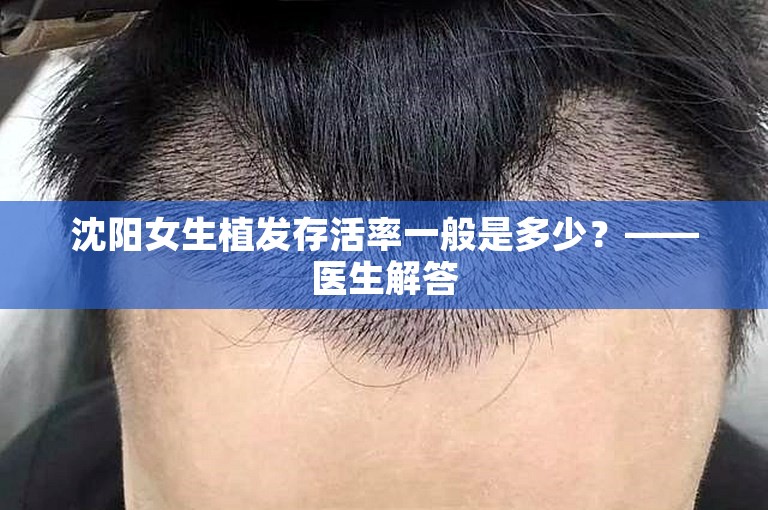 沈阳女生植发存活率一般是多少？——医生解答