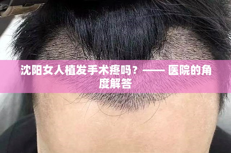 沈阳女人植发手术疼吗？—— 医院的角度解答