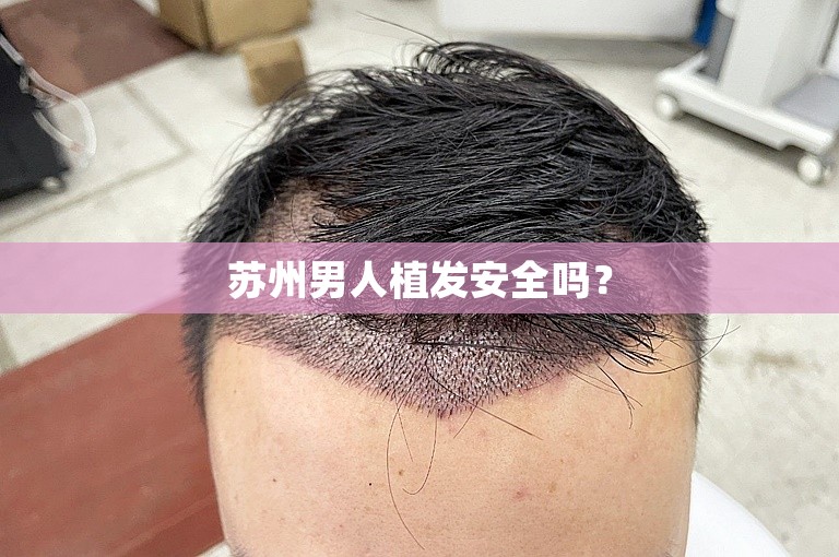 苏州男人植发安全吗？