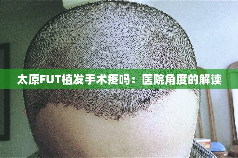 太原FUT植发手术疼吗：医院角度的解读