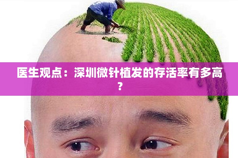 医生观点：深圳微针植发的存活率有多高？