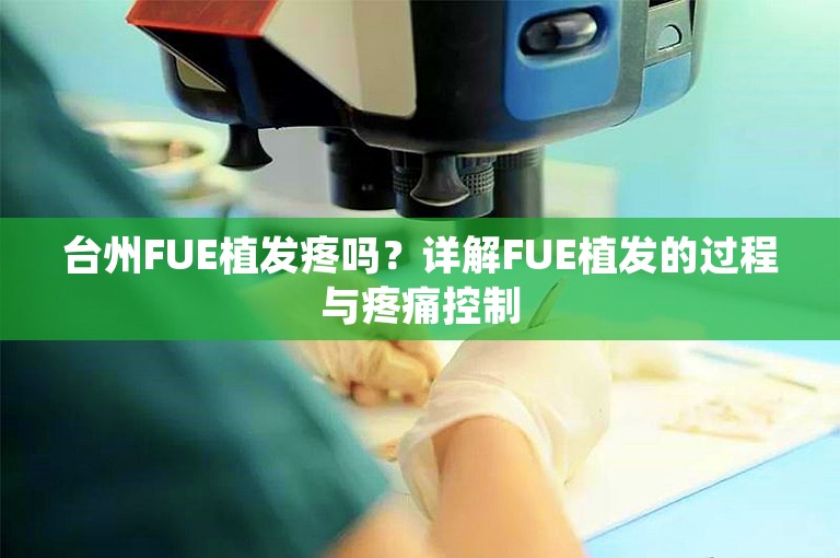 台州FUE植发疼吗？详解FUE植发的过程与疼痛控制