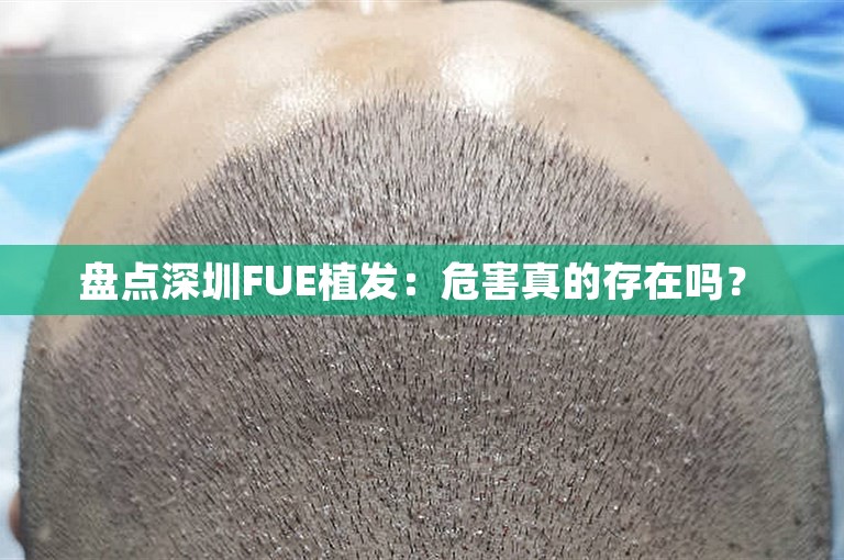  盘点深圳FUE植发：危害真的存在吗？ 