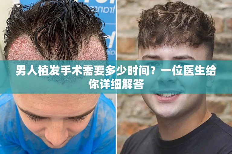 男人植发手术需要多少时间？一位医生给你详细解答