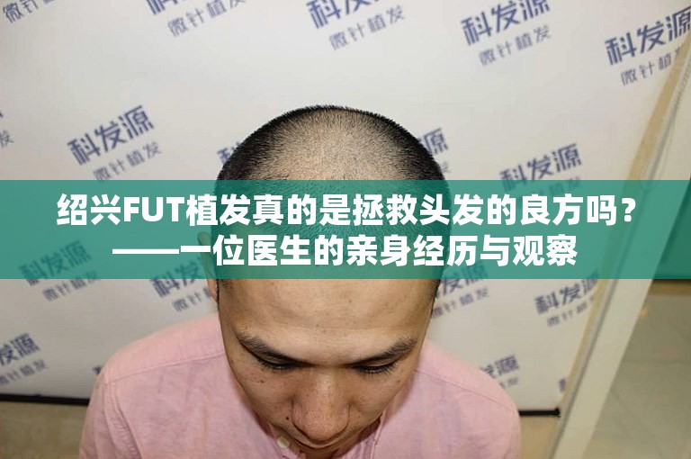 绍兴FUT植发真的是拯救头发的良方吗？——一位医生的亲身经历与观察