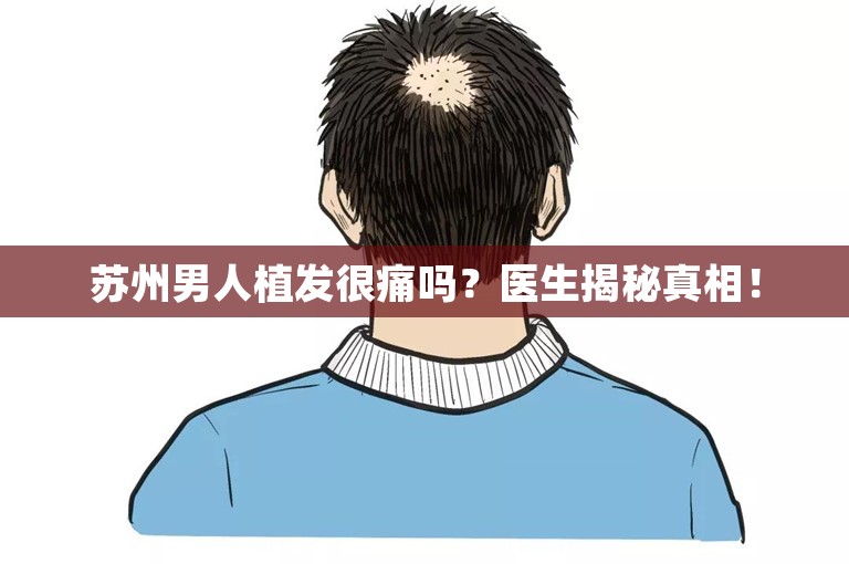 苏州男人植发很痛吗？医生揭秘真相！