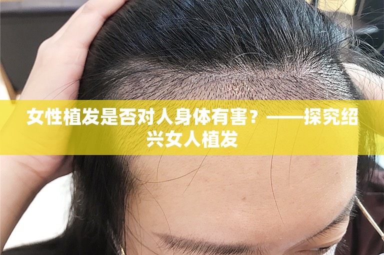 女性植发是否对人身体有害？——探究绍兴女人植发