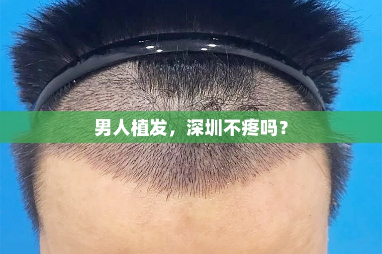 男人植发，深圳不疼吗？