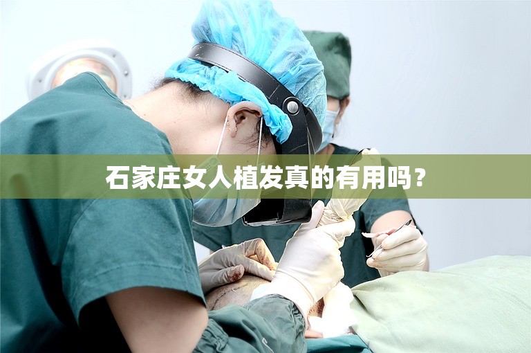 石家庄女人植发真的有用吗？