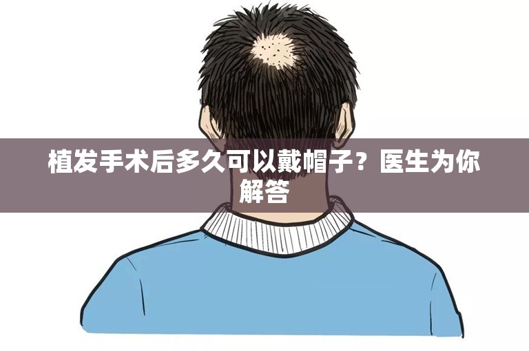 植发手术后多久可以戴帽子？医生为你解答