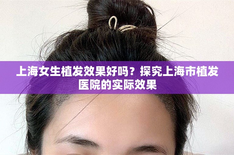 上海女生植发效果好吗？探究上海市植发医院的实际效果