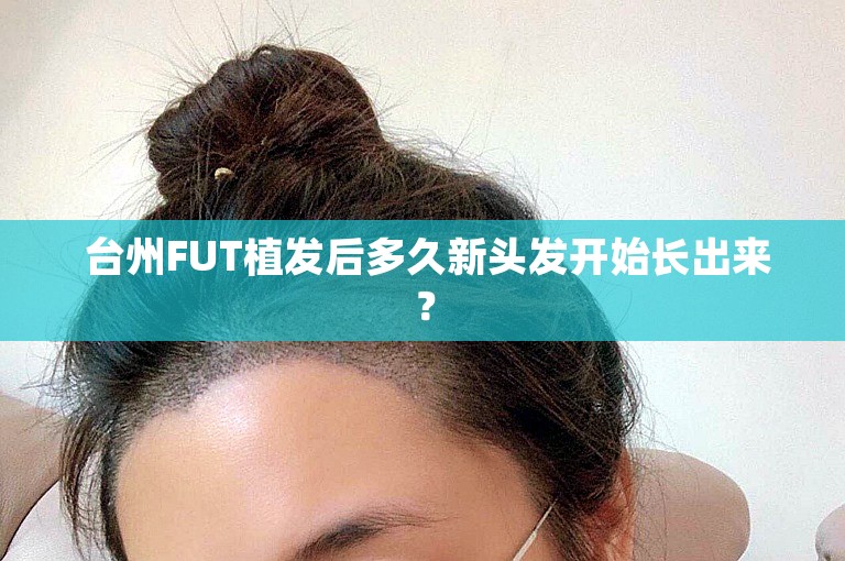  台州FUT植发后多久新头发开始长出来？