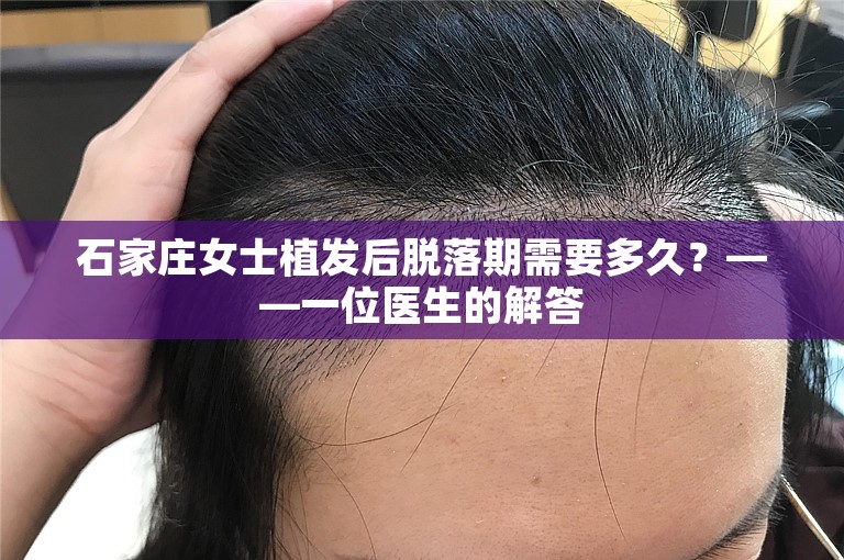 石家庄女士植发后脱落期需要多久？——一位医生的解答