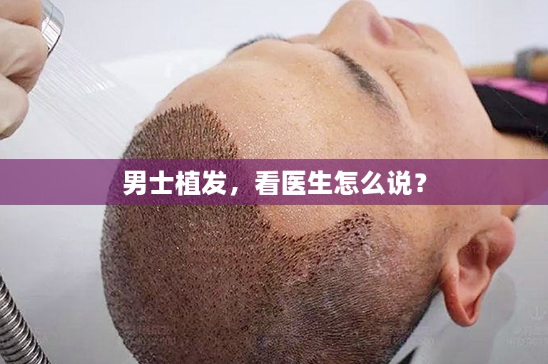 男士植发，看医生怎么说？