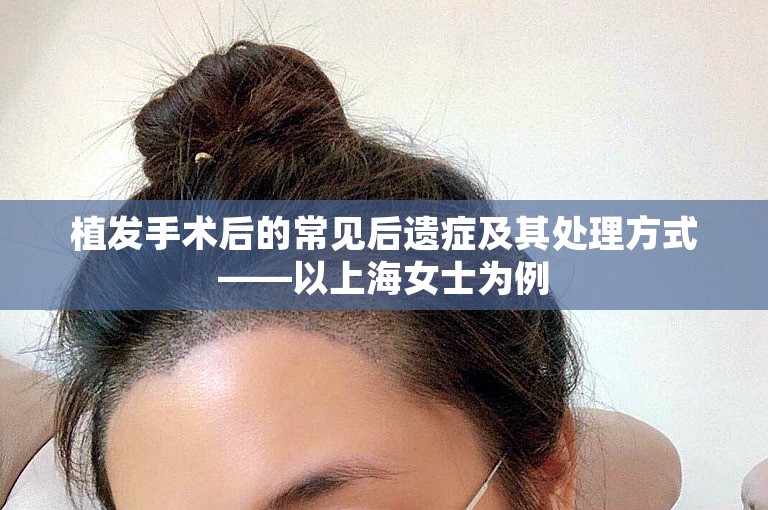 植发手术后的常见后遗症及其处理方式——以上海女士为例