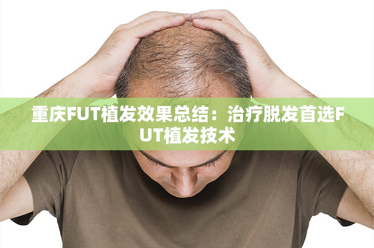 重庆FUT植发效果总结：治疗脱发首选FUT植发技术