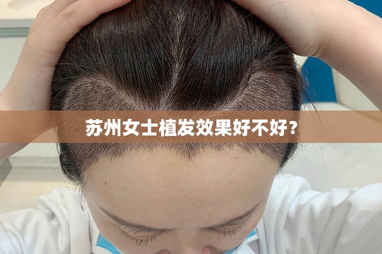 苏州女士植发效果好不好？