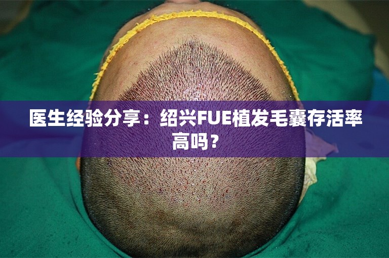 医生经验分享：绍兴FUE植发毛囊存活率高吗？