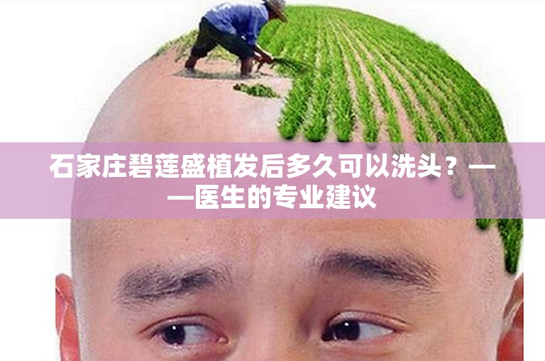 石家庄碧莲盛植发后多久可以洗头？——医生的专业建议