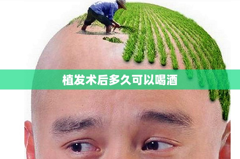 植发术后多久可以喝酒