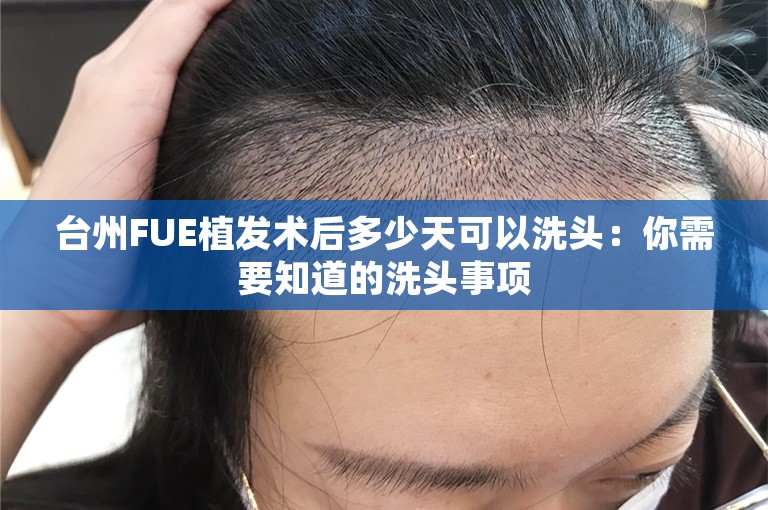 台州FUE植发术后多少天可以洗头：你需要知道的洗头事项