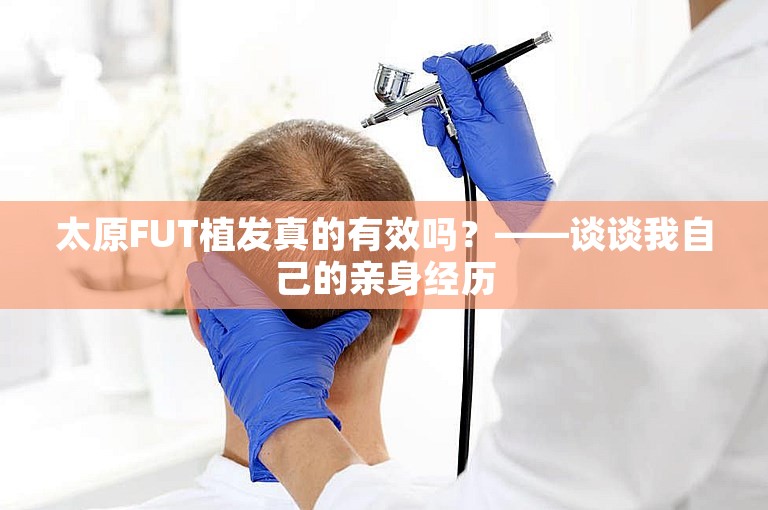 太原FUT植发真的有效吗？——谈谈我自己的亲身经历