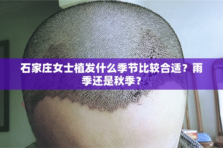 石家庄女士植发什么季节比较合适？雨季还是秋季？