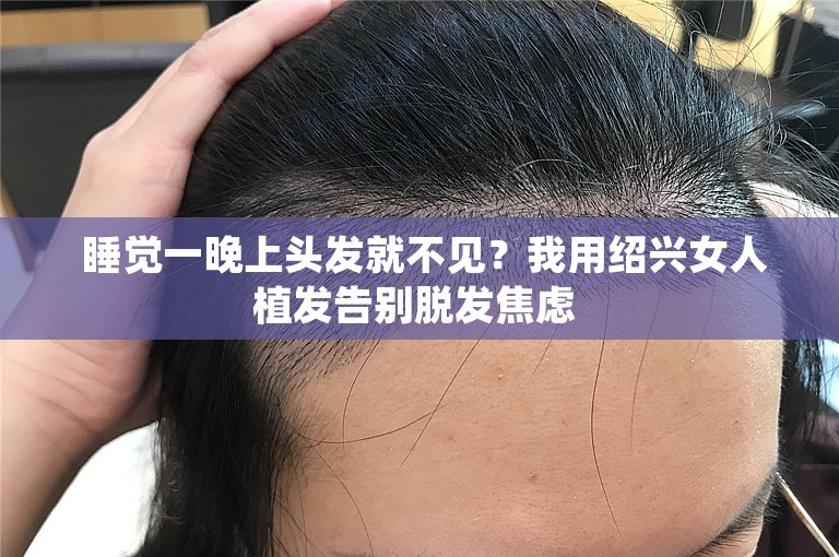  睡觉一晚上头发就不见？我用绍兴女人植发告别脱发焦虑 