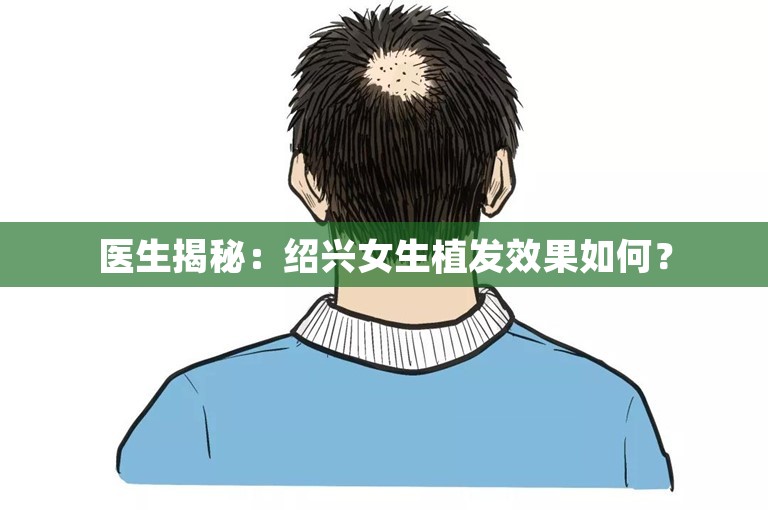 医生揭秘：绍兴女生植发效果如何？