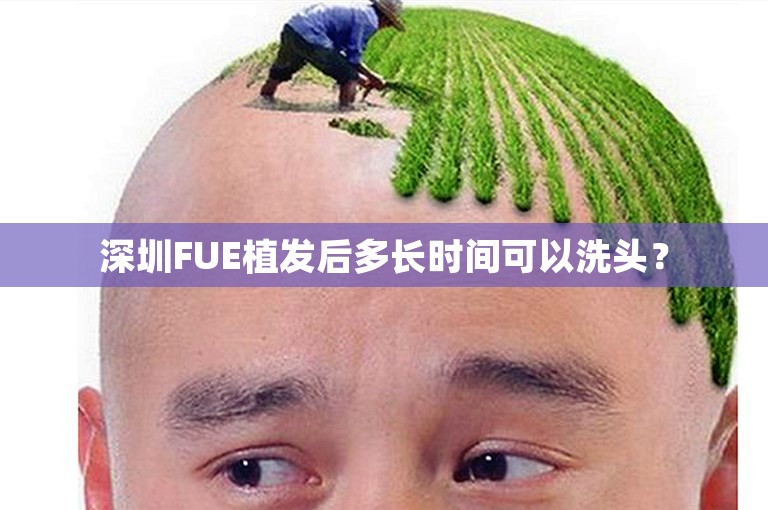 深圳FUE植发后多长时间可以洗头？