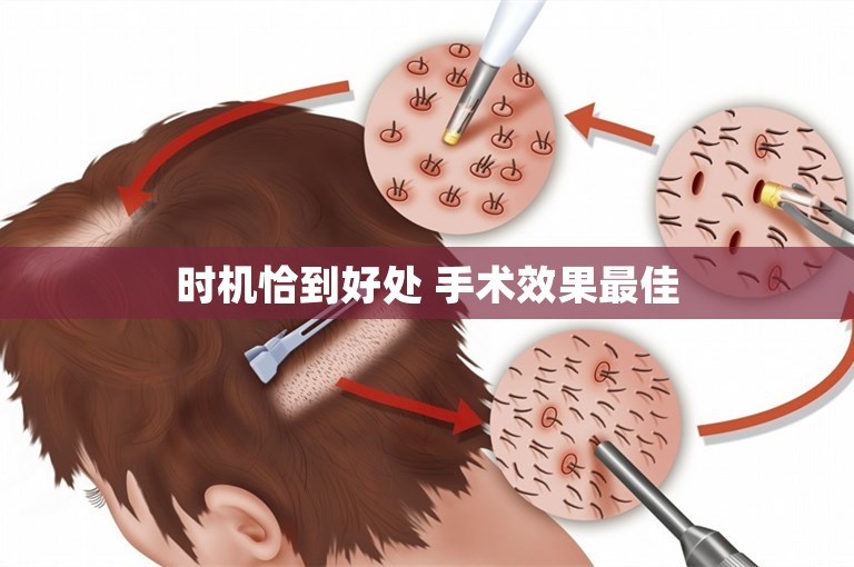 时机恰到好处 手术效果最佳