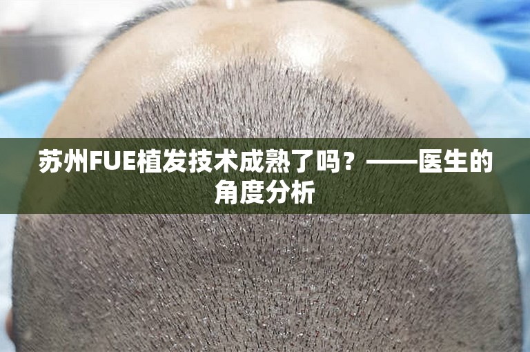 苏州FUE植发技术成熟了吗？——医生的角度分析