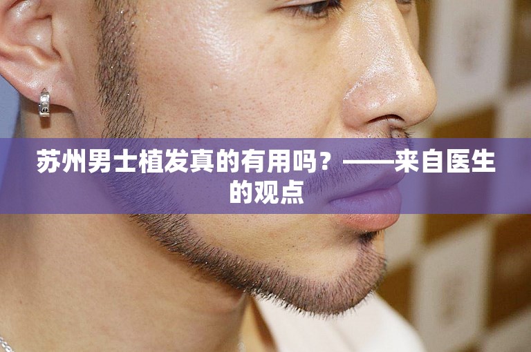 苏州男士植发真的有用吗？——来自医生的观点