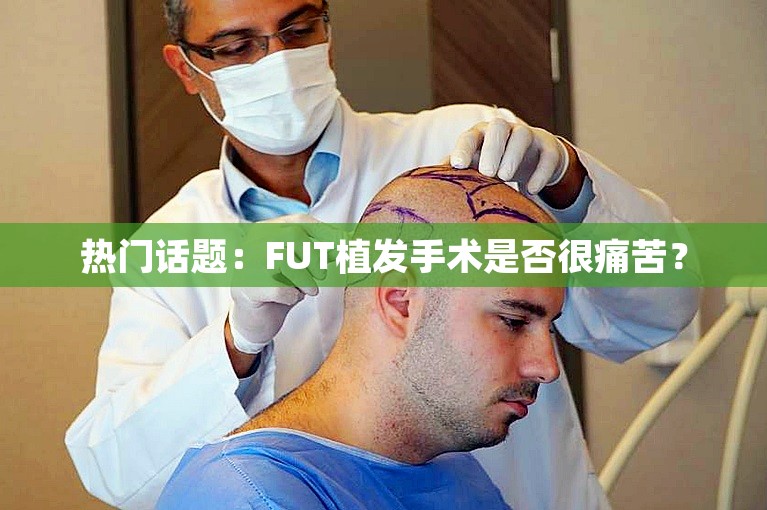 热门话题：FUT植发手术是否很痛苦？