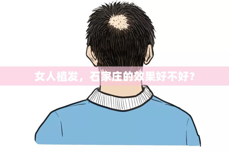 女人植发，石家庄的效果好不好？