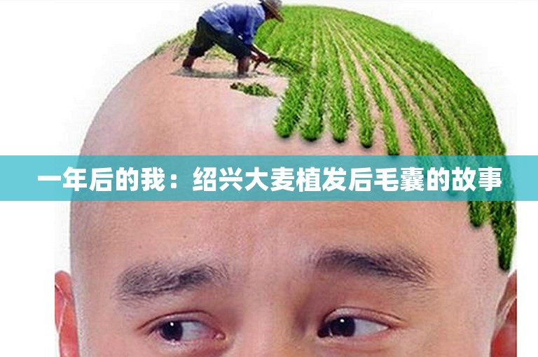 一年后的我：绍兴大麦植发后毛囊的故事