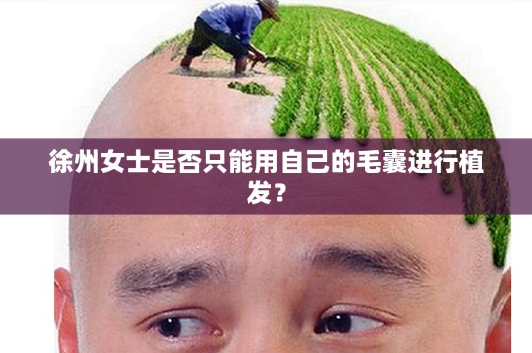 徐州女士是否只能用自己的毛囊进行植发？