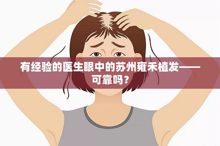 有经验的医生眼中的苏州雍禾植发——可靠吗？