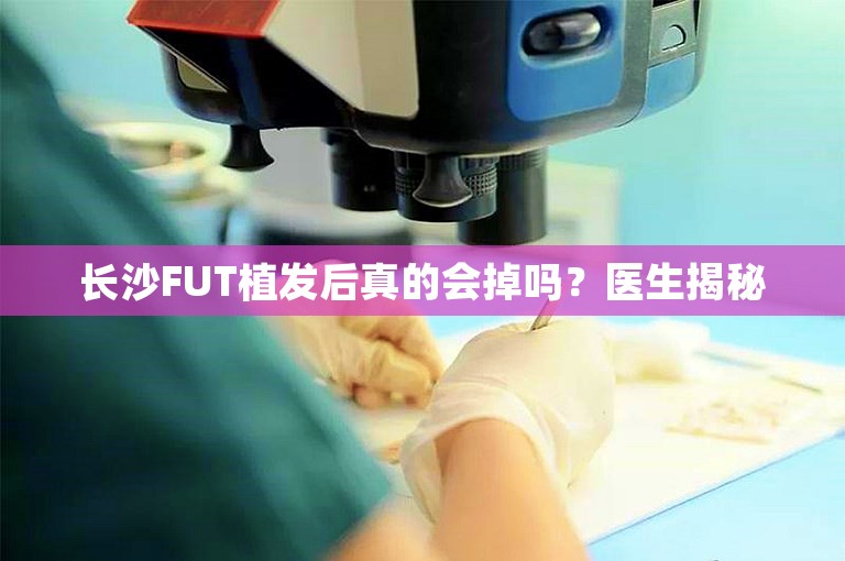 长沙FUT植发后真的会掉吗？医生揭秘