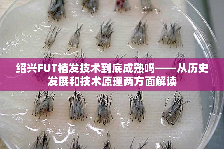 绍兴FUT植发技术到底成熟吗——从历史发展和技术原理两方面解读