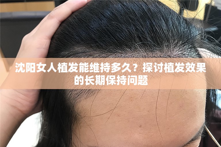 沈阳女人植发能维持多久？探讨植发效果的长期保持问题