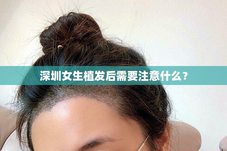 深圳女生植发后需要注意什么？