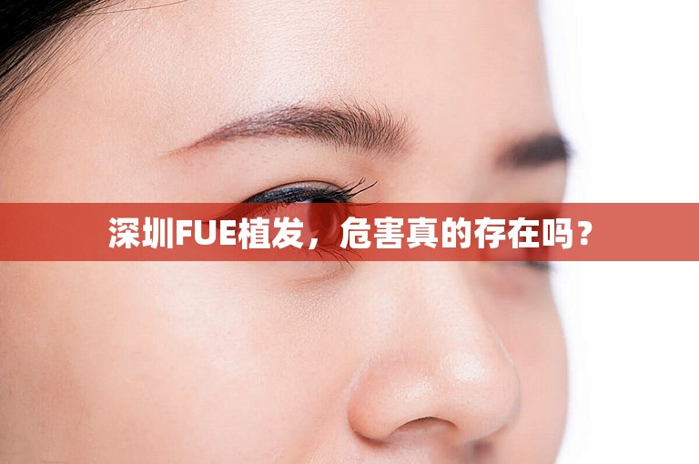 深圳FUE植发，危害真的存在吗？