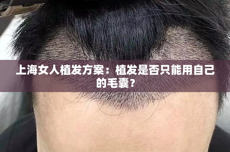 上海女人植发方案：植发是否只能用自己的毛囊？