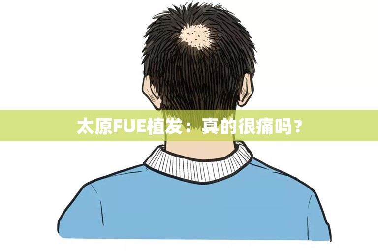 太原FUE植发：真的很痛吗？