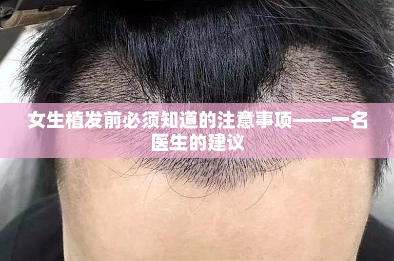 女生植发前必须知道的注意事项——一名医生的建议