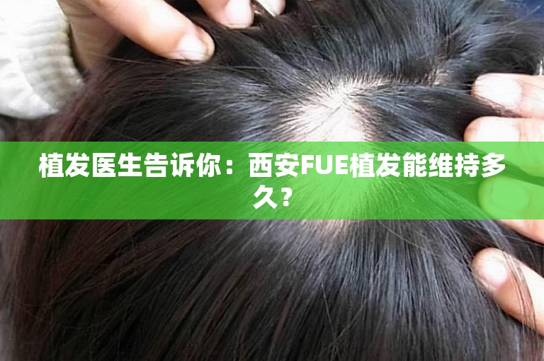 植发医生告诉你：西安FUE植发能维持多久？