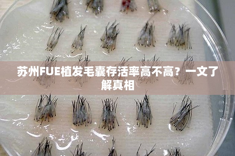 苏州FUE植发毛囊存活率高不高？一文了解真相